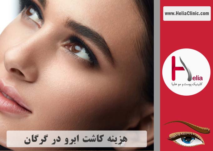 قیمت کاشت ابروی طبیعی در گرگان