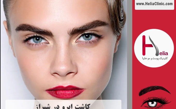 کاشت ابرو در شیراز - استان فارس