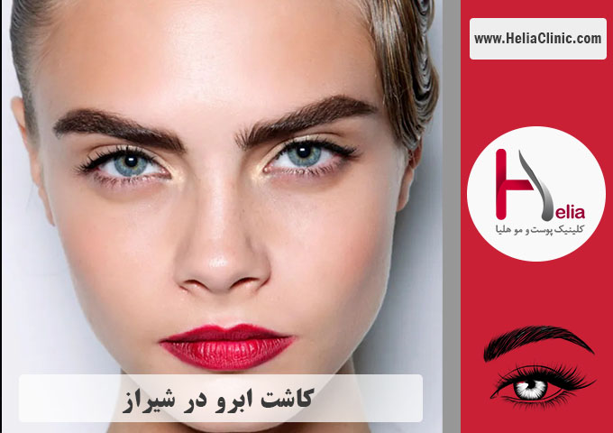 کاشت ابرو در شیراز - استان فارس