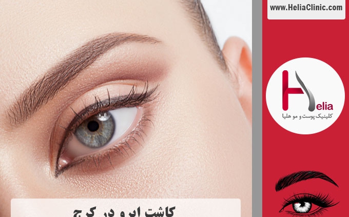 کاشت ابروی طبیعی در کرج - استان البرز