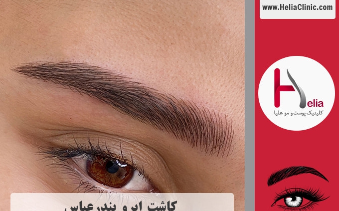 کاشت ابرو در بندرعباس - هرمزگان
