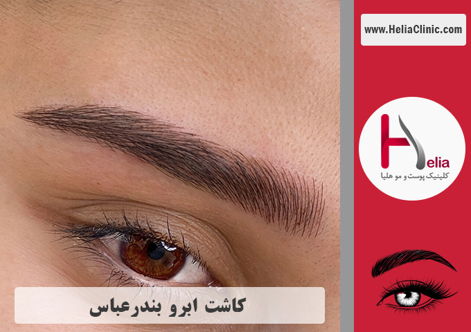 کاشت ابرو در بندرعباس - هرمزگان