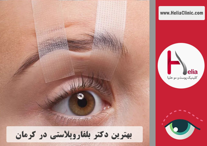 بهترین جراح بلفاروپلاستی در کرمان