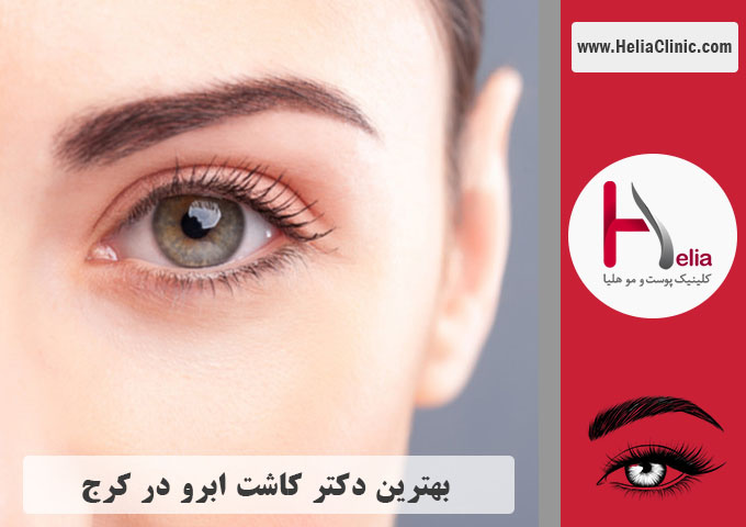 بهترین دکتر و مرکز کاشت ابروی تخصصی در کرچ