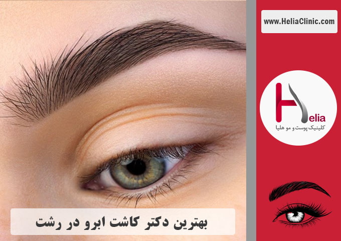 بهترین دکتر و مرکز کاشت ابروی طبیعی در شهر رشت