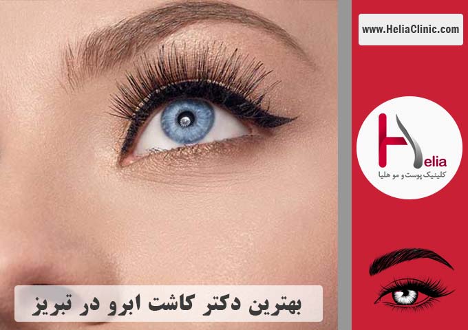 بهترین دکتر و مرکز کاشت ابرو در شهر تبریز