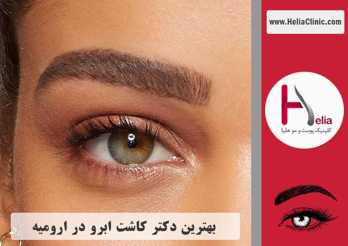 بهترین دکتر کاشت ابرو در ارومیه