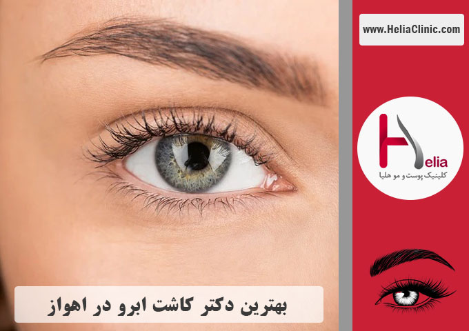 بهترین پزشک و مرکز کاشت ابرو در اهواز