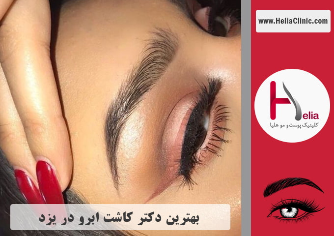 بهترین پزشک و مرکز کاشت ابرو در شهر یزد