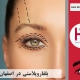 عمل جراجی پلک در اصفهان