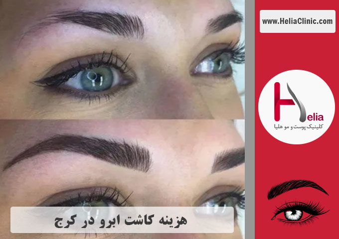 قیمت کاشت ابروی طبیعی در شهر کرج