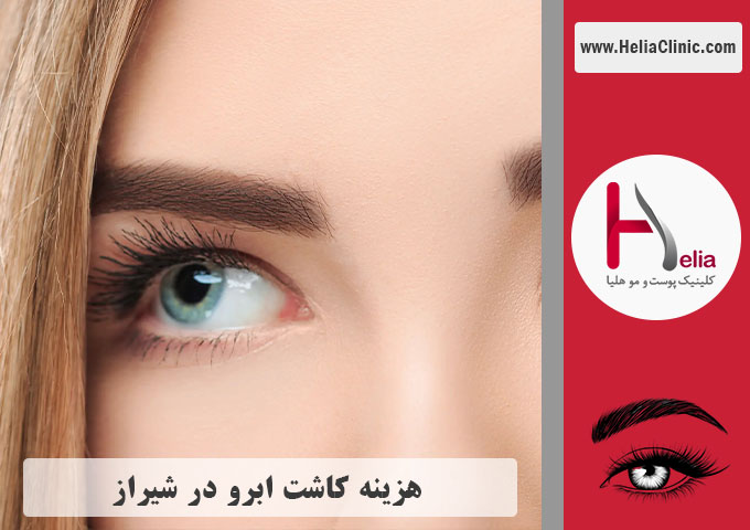قیمت کاشت ابرو در شیراز