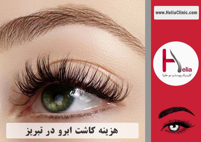 قیمت کاشت ابروی طبیعی در تبریز