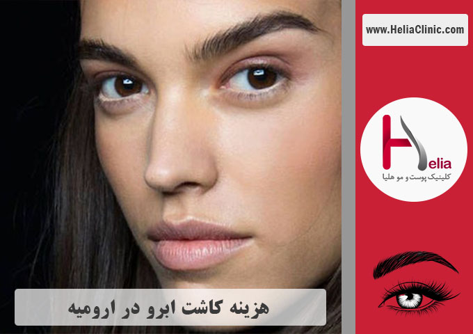 قیمت کاشت ابرو در شهر ارومیه