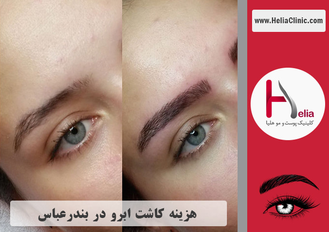 قیمت کاشت ابروی طبیعی در بندرعباس