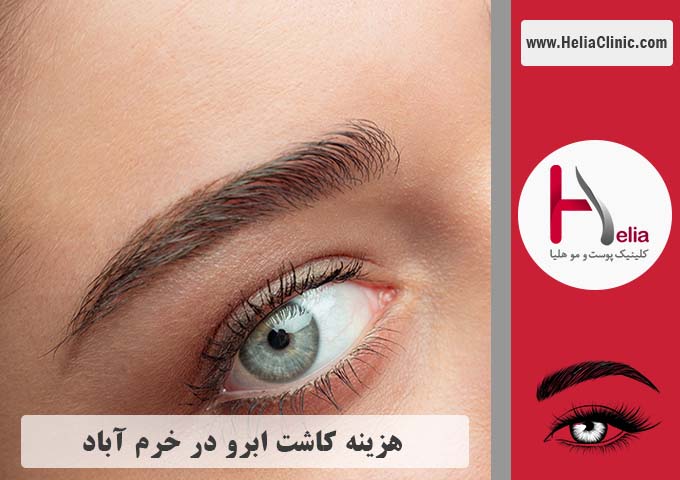 هزینه کاشت ابرو در خرم آباد