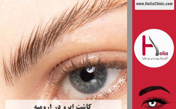 کاشت ابرو در شهر ارومیه