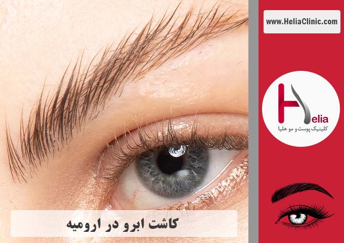 کاشت ابرو در شهر ارومیه