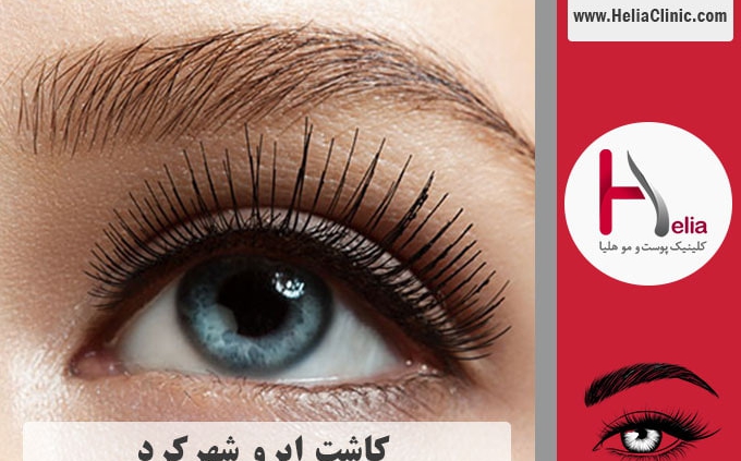 کاشت ابرو شهرکرد