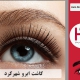 کاشت ابرو شهرکرد