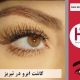 کاشت ابرو در شهر تبریز