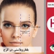 عمل جراحی پلک در کرج