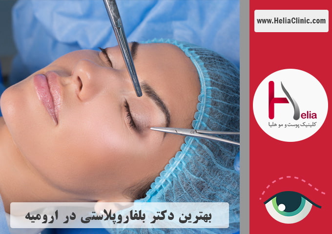 بهترین جراح پلک در شهر ارومیه