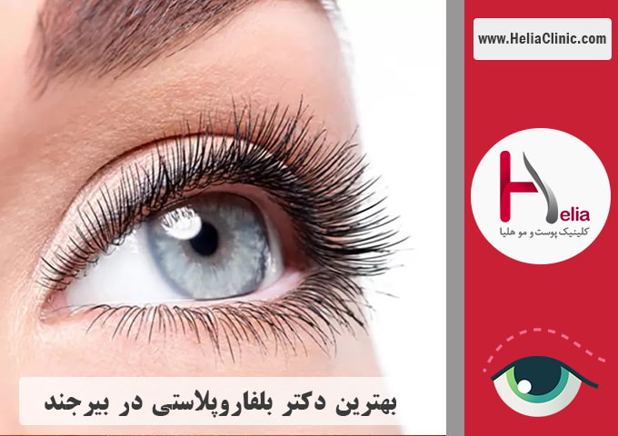 بهترین جراح پلک در بیرجند