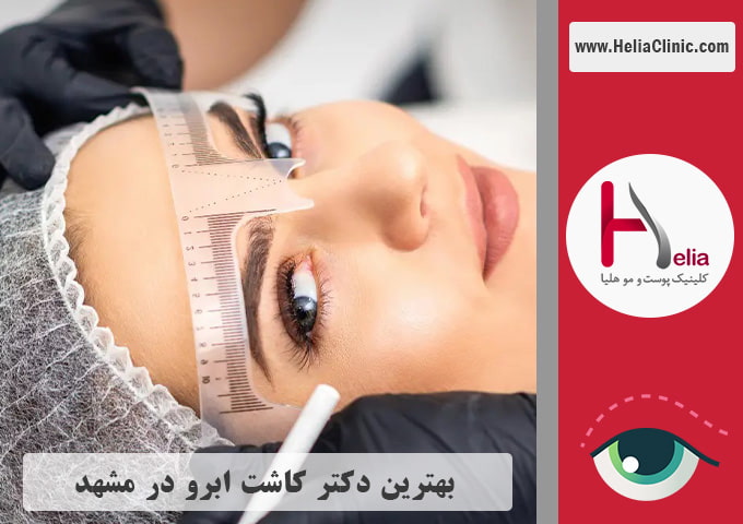 بهترین متخصص و مرکز کاشت ابرو در مشهد