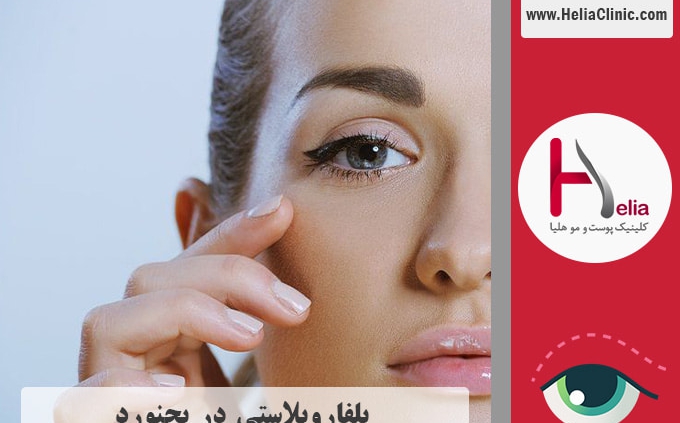 عمل بلفاروپلاستی در بجنورد