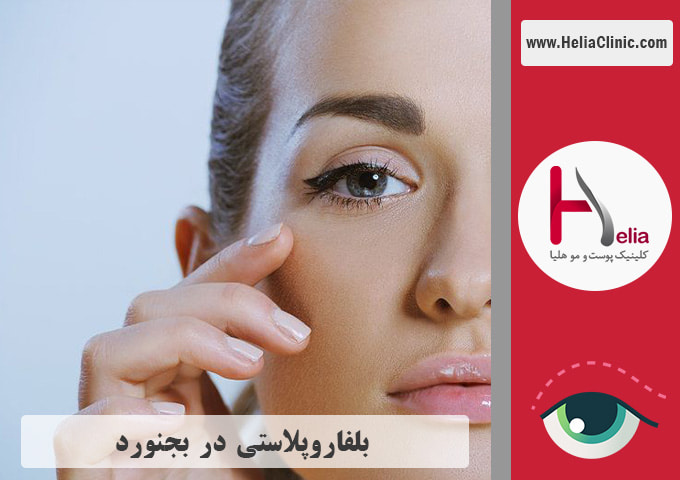 عمل بلفاروپلاستی در بجنورد