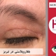 عمل بلفاروپلاستی در تبریز