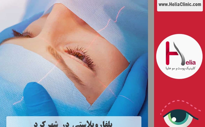 عمل بلفاروپلاستی در شهرکرد