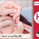 عمل بلفاروپلاستی در ارومیه