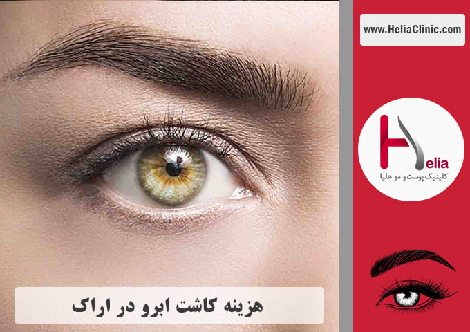 قیمت کاشت ابروی طبیعی در اراک