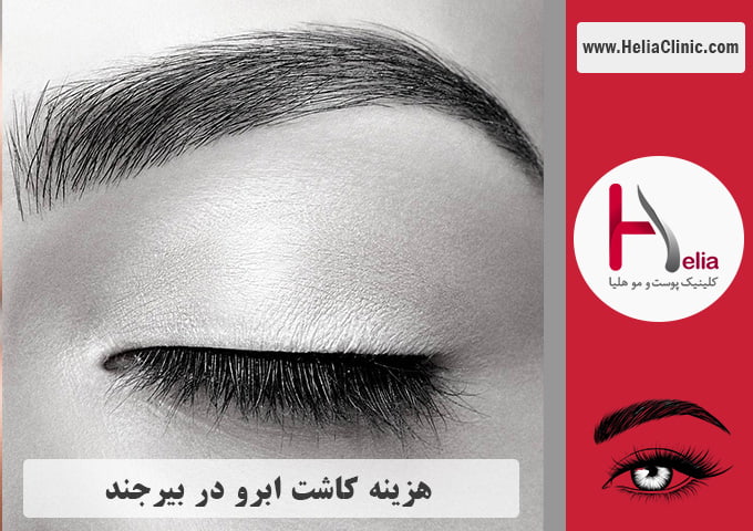 قیمت کاشت ابروی طبیعی در بیرجند