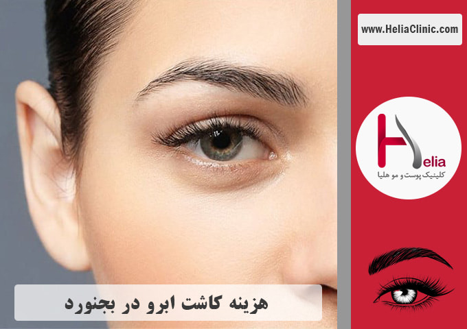 قیمت کاشت ابروی طبیعی در بجنورد