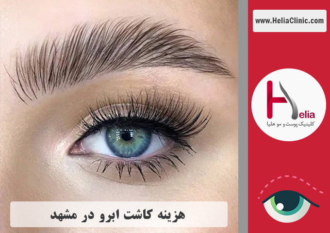 قیمت کاشت ابروی طبیعی در مشهد