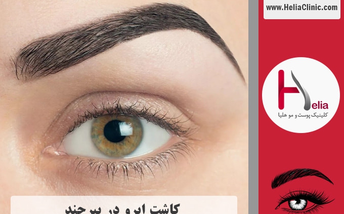 کاشت ابروی طبیعی در بیرجند