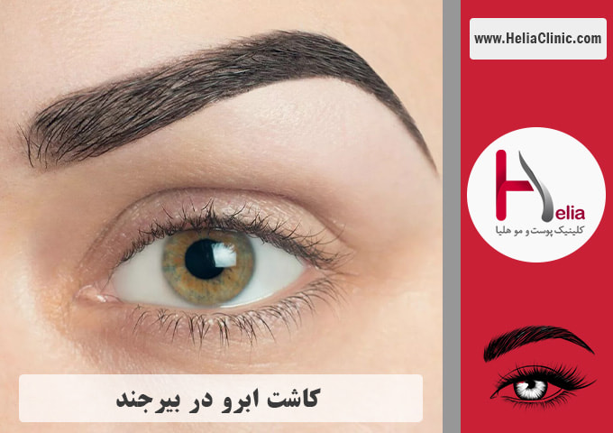 کاشت ابروی طبیعی در بیرجند