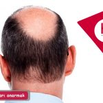 Seyrek saçları onarmak