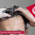 Saç ekimi sonrası saçın yıkanması
