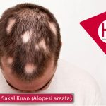 Saçkıran ve Sakal Kıran