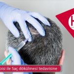 Mezoterapisi ile Saç dökülmesi tedavisine Kesin Çözüm