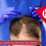 Kısa Ve Uzun Süreli Saç Ekiminin Yan Etkileri