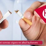 Saç ekimi sonrası sigara ve alkol kullanımı