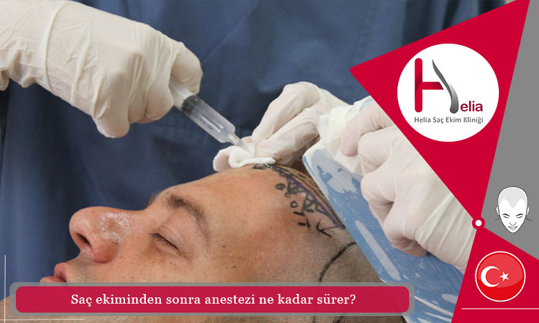 Saç ekiminden sonra anestezi ne kadar sürer?