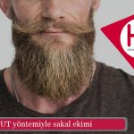 FUT sakal ekiminin maliyeti ne kadar?