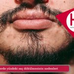 Erkeklerde yüzdeki saç dökülmesinin nedenleri