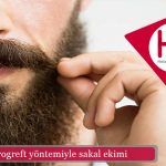 mikrogreft yöntemiyle sakal ekimi